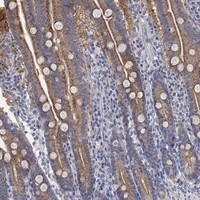 RGS1 Antibody in Immunohistochemistry (Paraffin) (IHC (P))