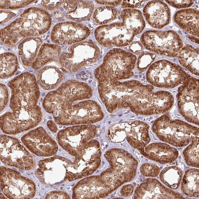 OXER1 Antibody in Immunohistochemistry (Paraffin) (IHC (P))