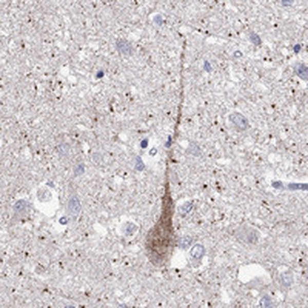 MC3R Antibody in Immunohistochemistry (Paraffin) (IHC (P))