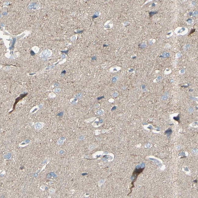 GPR34 Antibody in Immunohistochemistry (Paraffin) (IHC (P))