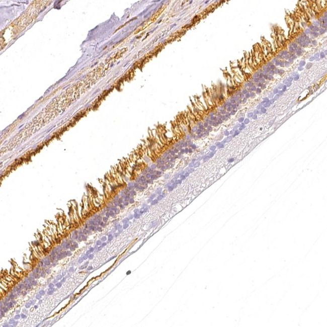 GNAT1 Antibody in Immunohistochemistry (Paraffin) (IHC (P))