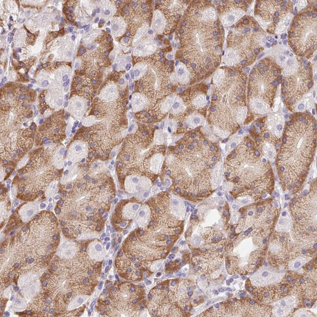 ADAM8 Antibody in Immunohistochemistry (Paraffin) (IHC (P))