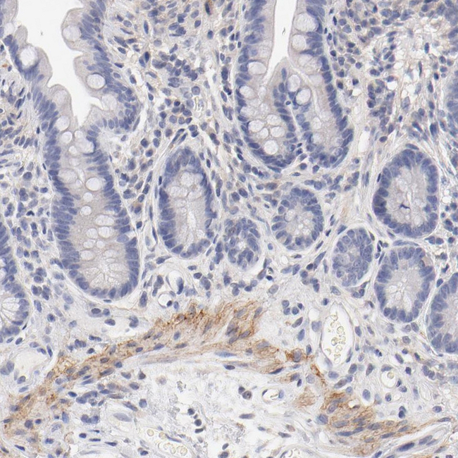 ITGA8 Antibody in Immunohistochemistry (Paraffin) (IHC (P))