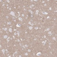 KCNH6 Antibody in Immunohistochemistry (Paraffin) (IHC (P))