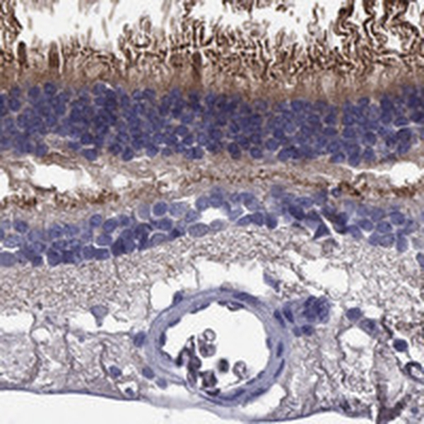 ABCA4 Antibody in Immunohistochemistry (Paraffin) (IHC (P))