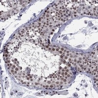 TAF9 Antibody in Immunohistochemistry (Paraffin) (IHC (P))
