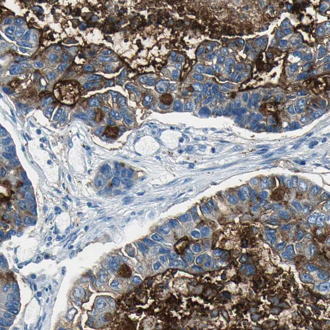 MUC4 Antibody in Immunohistochemistry (Paraffin) (IHC (P))