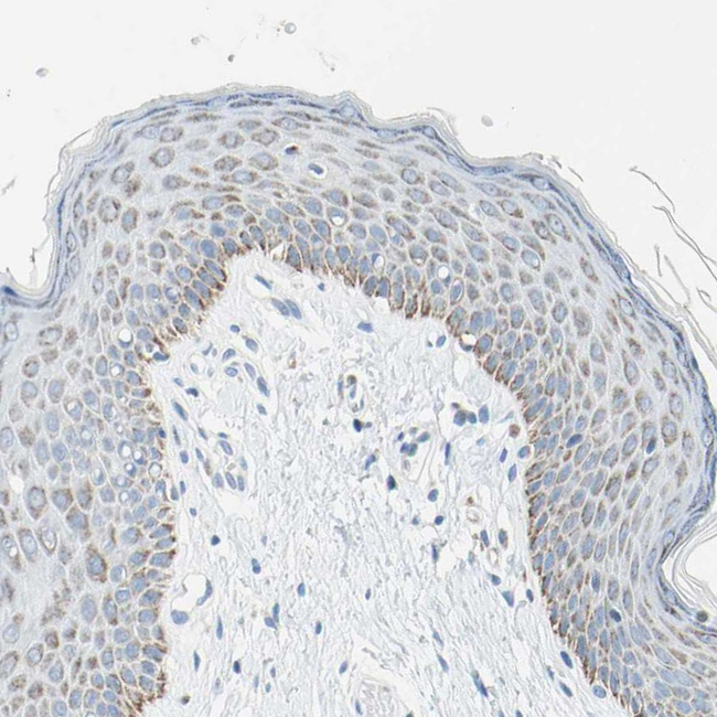CYSLTR1 Antibody in Immunohistochemistry (Paraffin) (IHC (P))