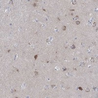 WASF3 Antibody in Immunohistochemistry (Paraffin) (IHC (P))