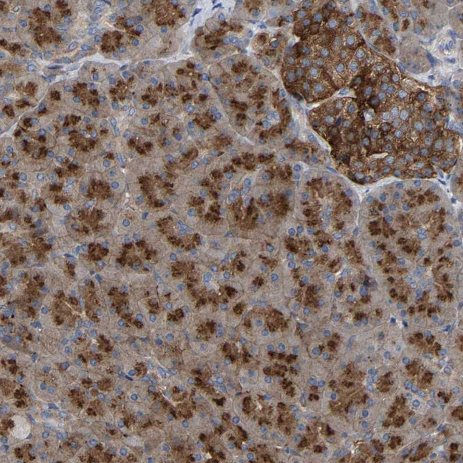 GADD34 Antibody in Immunohistochemistry (Paraffin) (IHC (P))