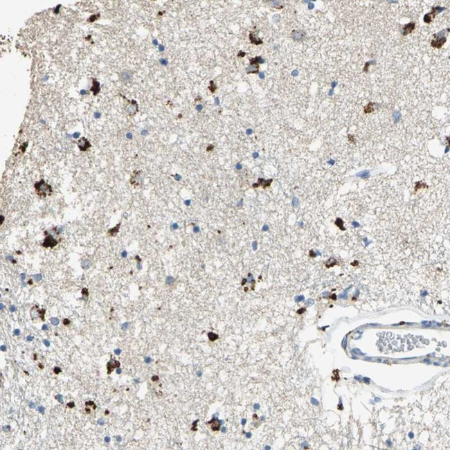 ADAMTS5 Antibody in Immunohistochemistry (Paraffin) (IHC (P))