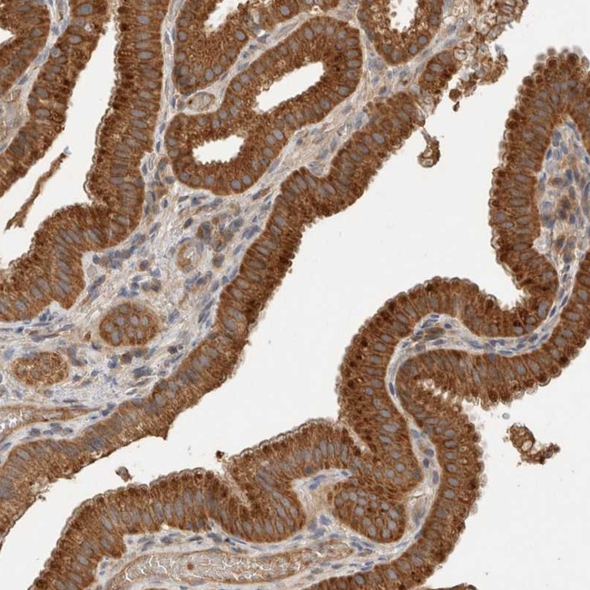 SGK3 Antibody in Immunohistochemistry (Paraffin) (IHC (P))