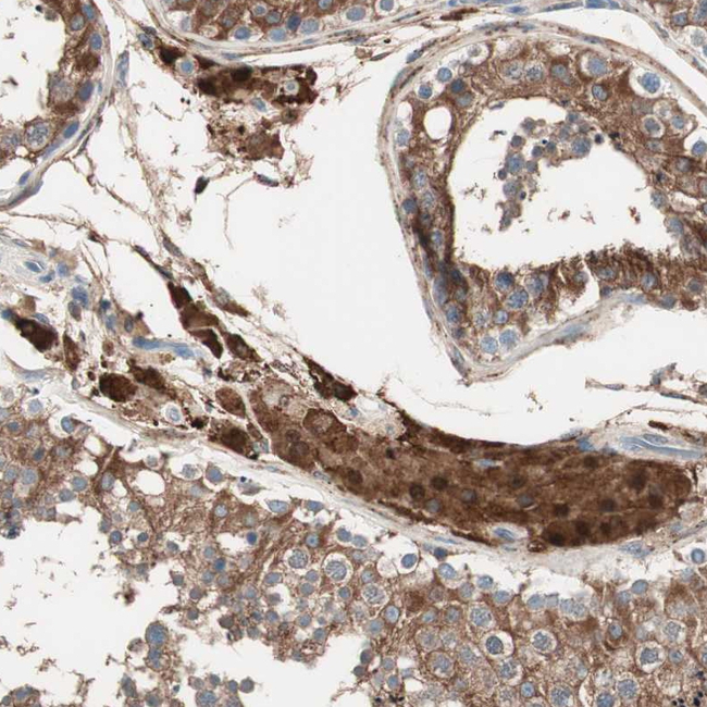 RAD54B Antibody in Immunohistochemistry (Paraffin) (IHC (P))