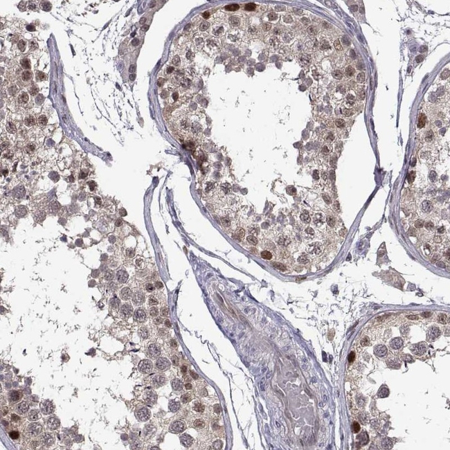 CHFR Antibody in Immunohistochemistry (Paraffin) (IHC (P))