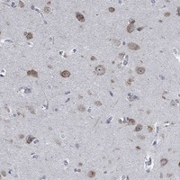 MMP24 Antibody in Immunohistochemistry (Paraffin) (IHC (P))