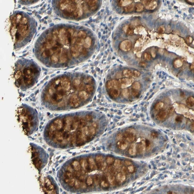 Urokinase Antibody in Immunohistochemistry (Paraffin) (IHC (P))