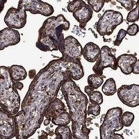 Urokinase Antibody in Immunohistochemistry (Paraffin) (IHC (P))