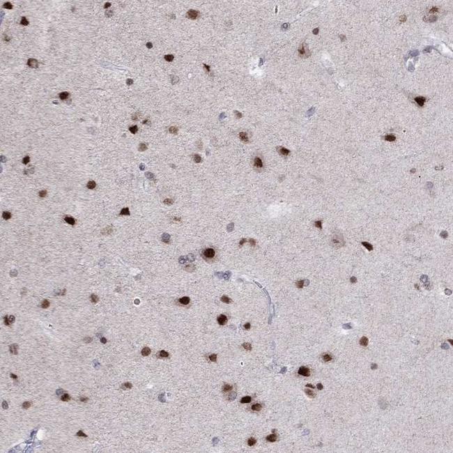 HES5 Antibody in Immunohistochemistry (Paraffin) (IHC (P))
