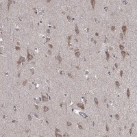 Iduronate 2 Sulfatase Antibody in Immunohistochemistry (Paraffin) (IHC (P))