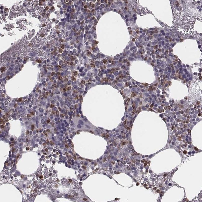 SCF Antibody in Immunohistochemistry (Paraffin) (IHC (P))