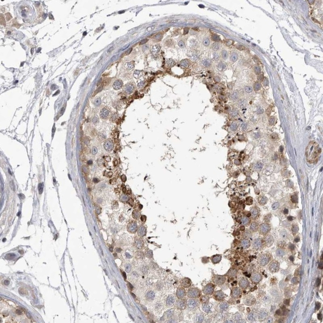SSX2IP Antibody in Immunohistochemistry (Paraffin) (IHC (P))