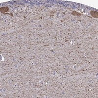 FEZ1 Antibody in Immunohistochemistry (Paraffin) (IHC (P))
