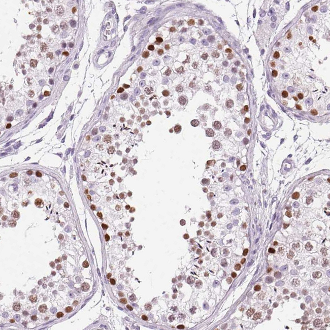SP7 Antibody in Immunohistochemistry (Paraffin) (IHC (P))