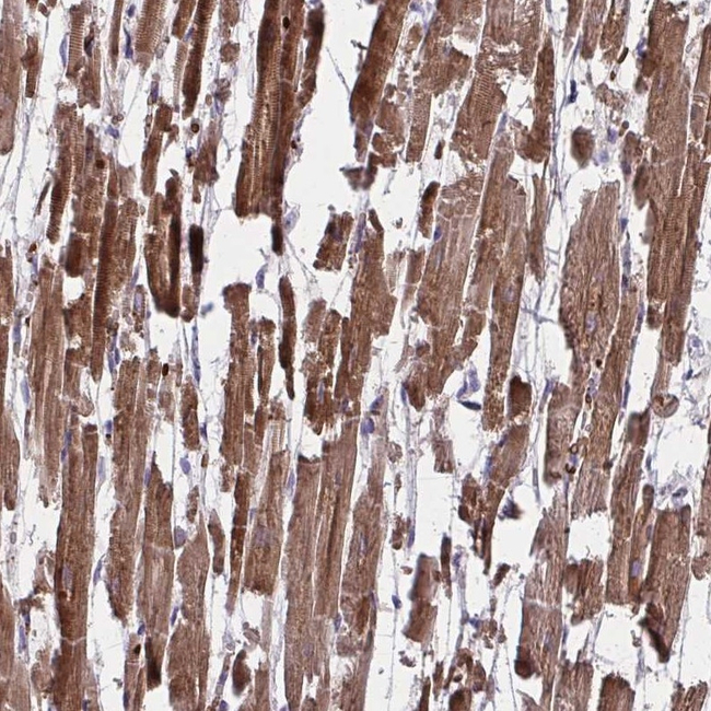 PDK4 Antibody in Immunohistochemistry (Paraffin) (IHC (P))