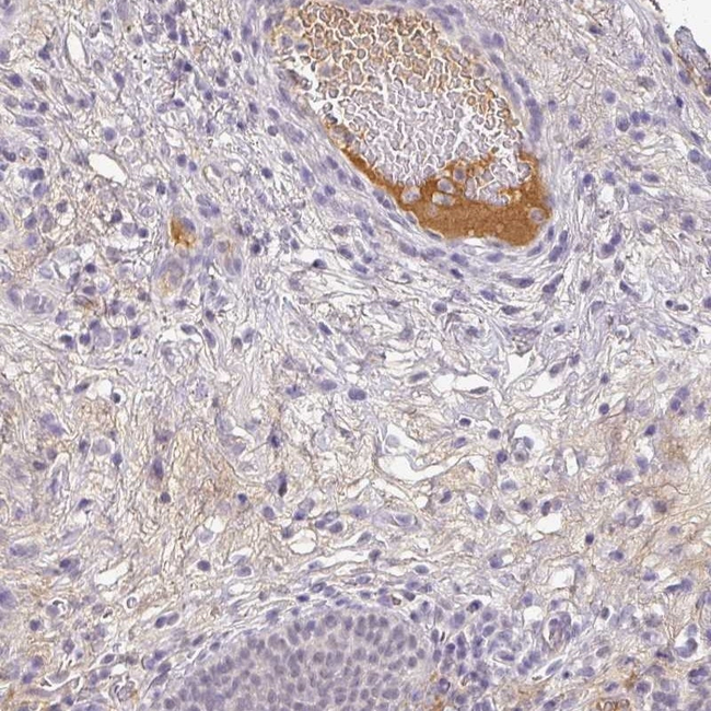 C1QB Antibody in Immunohistochemistry (Paraffin) (IHC (P))