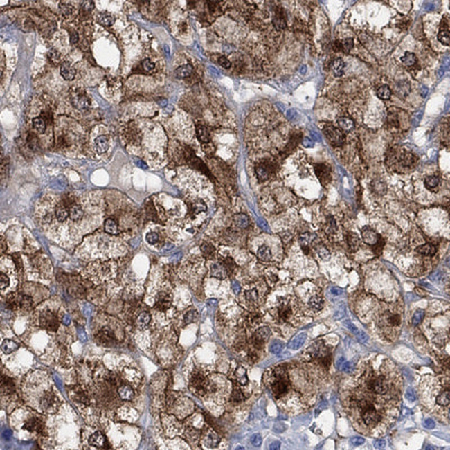 CPLX2 Antibody in Immunohistochemistry (Paraffin) (IHC (P))