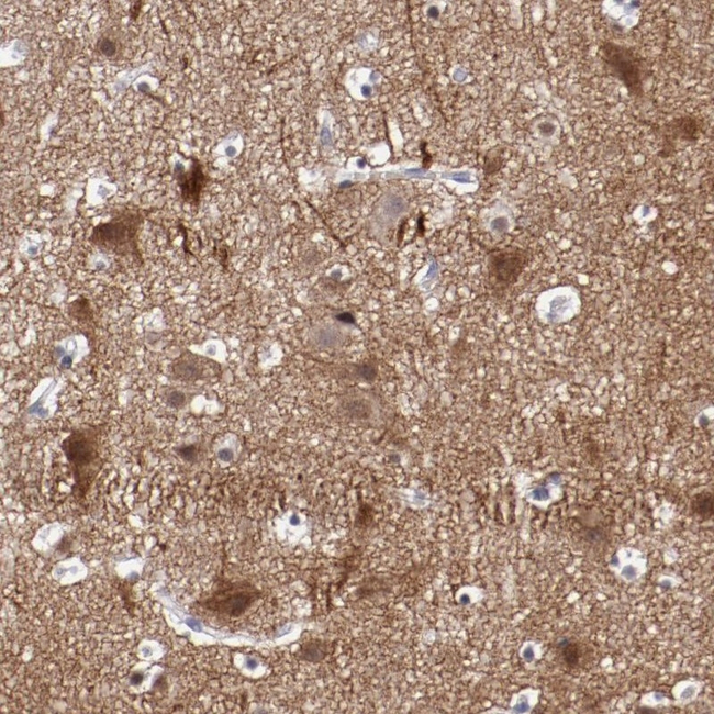 NRXN3 Antibody in Immunohistochemistry (Paraffin) (IHC (P))