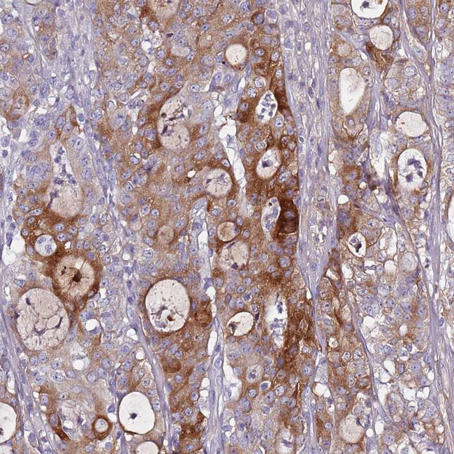 DcR3 Antibody in Immunohistochemistry (Paraffin) (IHC (P))
