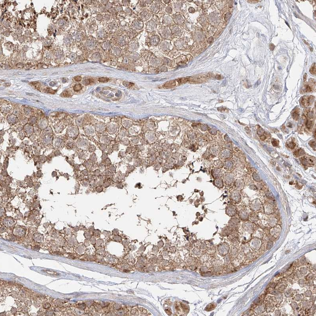 AIM2 Antibody in Immunohistochemistry (Paraffin) (IHC (P))