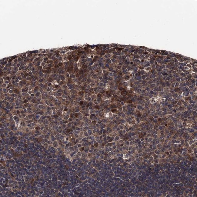 Cdc23 Antibody in Immunohistochemistry (Paraffin) (IHC (P))