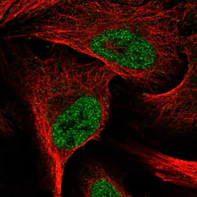 E2F6 Antibody in Immunocytochemistry (ICC/IF)