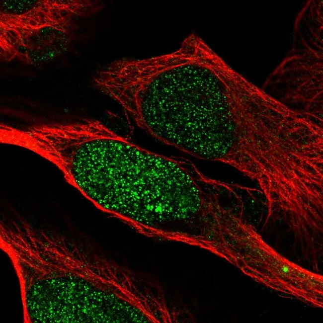 PSME2 Antibody in Immunocytochemistry (ICC/IF)