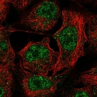 STARD3 Antibody in Immunocytochemistry (ICC/IF)