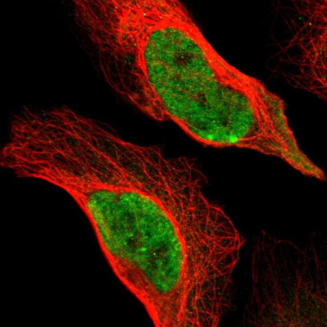 MRE11 Antibody in Immunocytochemistry (ICC/IF)