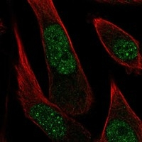 PPP2R3B Antibody in Immunocytochemistry (ICC/IF)
