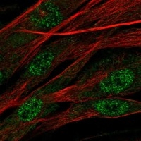 Asporin Antibody in Immunocytochemistry (ICC/IF)