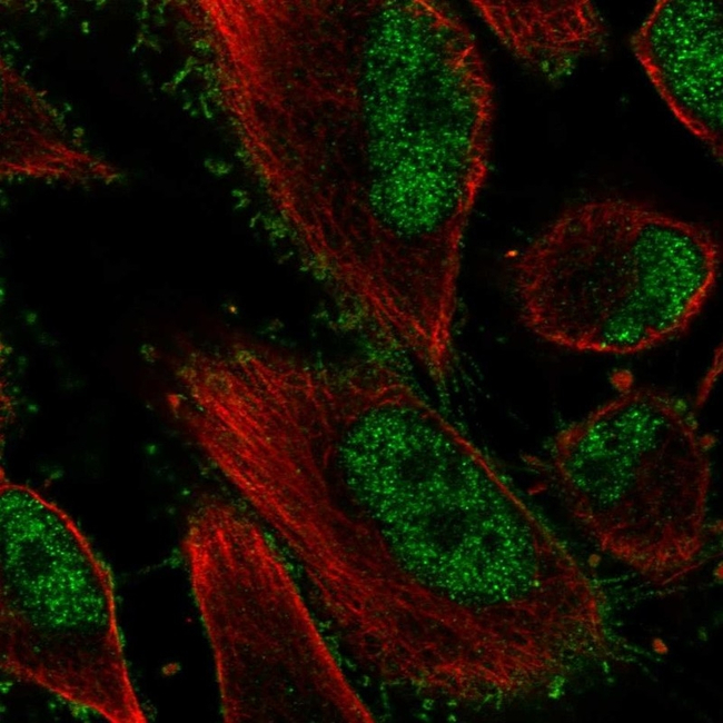 EphB2 Antibody in Immunocytochemistry (ICC/IF)