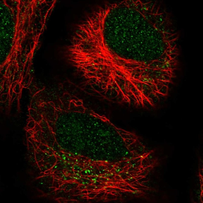 LRRK2 Antibody in Immunocytochemistry (ICC/IF)