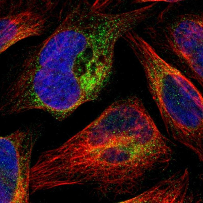 ARMET Antibody in Immunocytochemistry (ICC/IF)