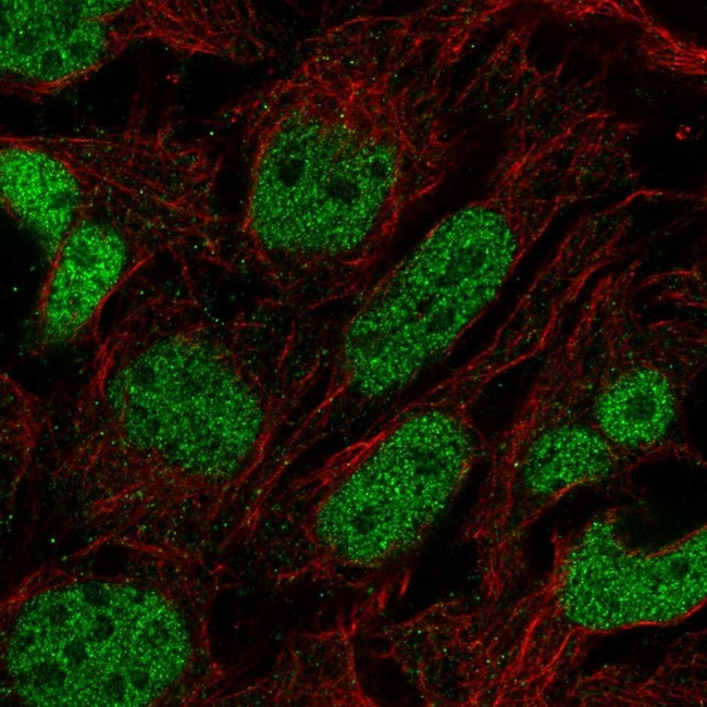 PRDM16 Antibody in Immunocytochemistry (ICC/IF)