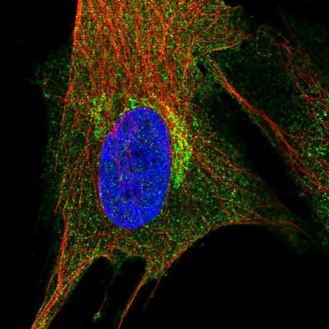PIP4K2A Antibody in Immunocytochemistry (ICC/IF)