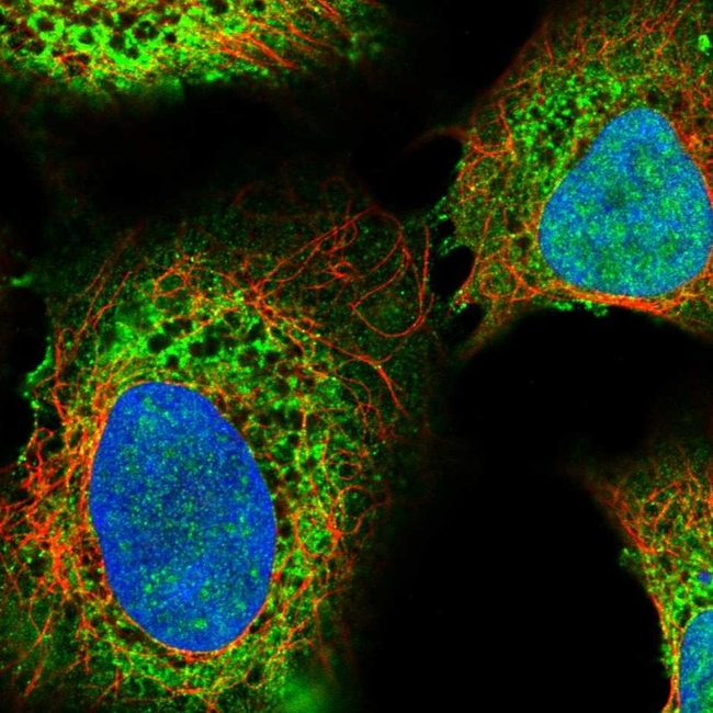 IP3 Receptor 2 Antibody in Immunocytochemistry (ICC/IF)