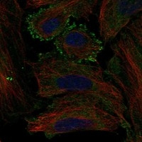 MC5R Antibody in Immunocytochemistry (ICC/IF)