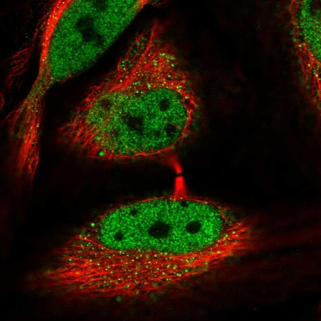 NCoR1 Antibody in Immunocytochemistry (ICC/IF)