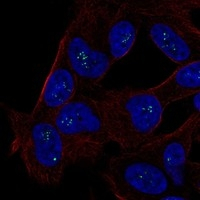 ALX3 Antibody in Immunocytochemistry (ICC/IF)