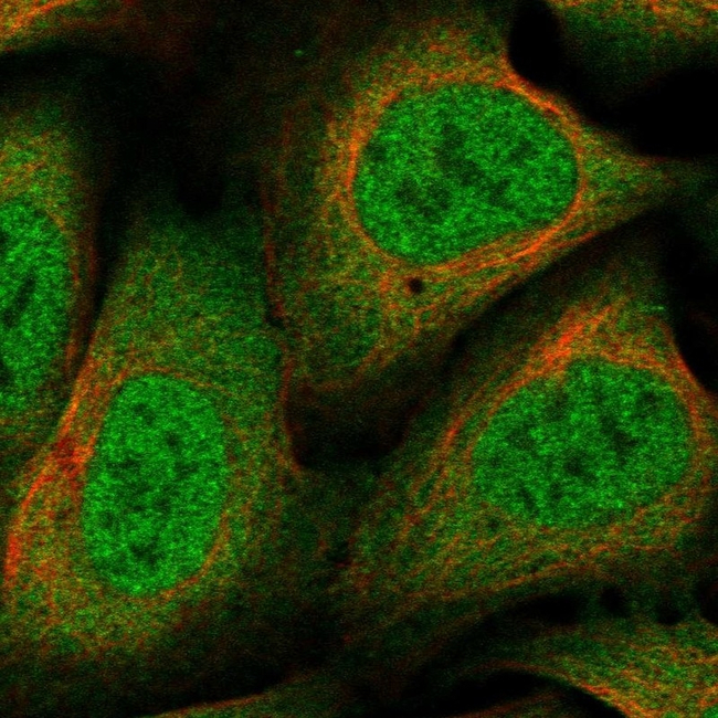 NCoR1 Antibody in Immunocytochemistry (ICC/IF)